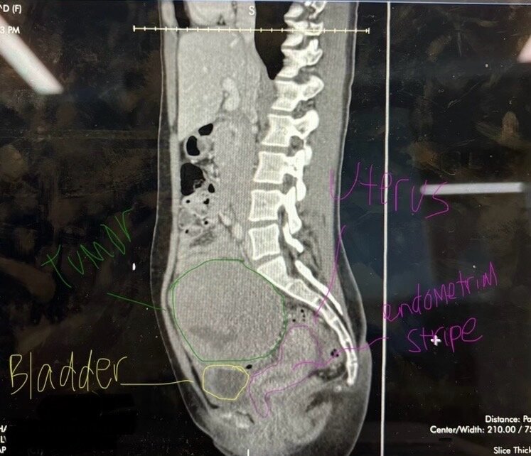 PET/CT cross-section from diagnostic imaging